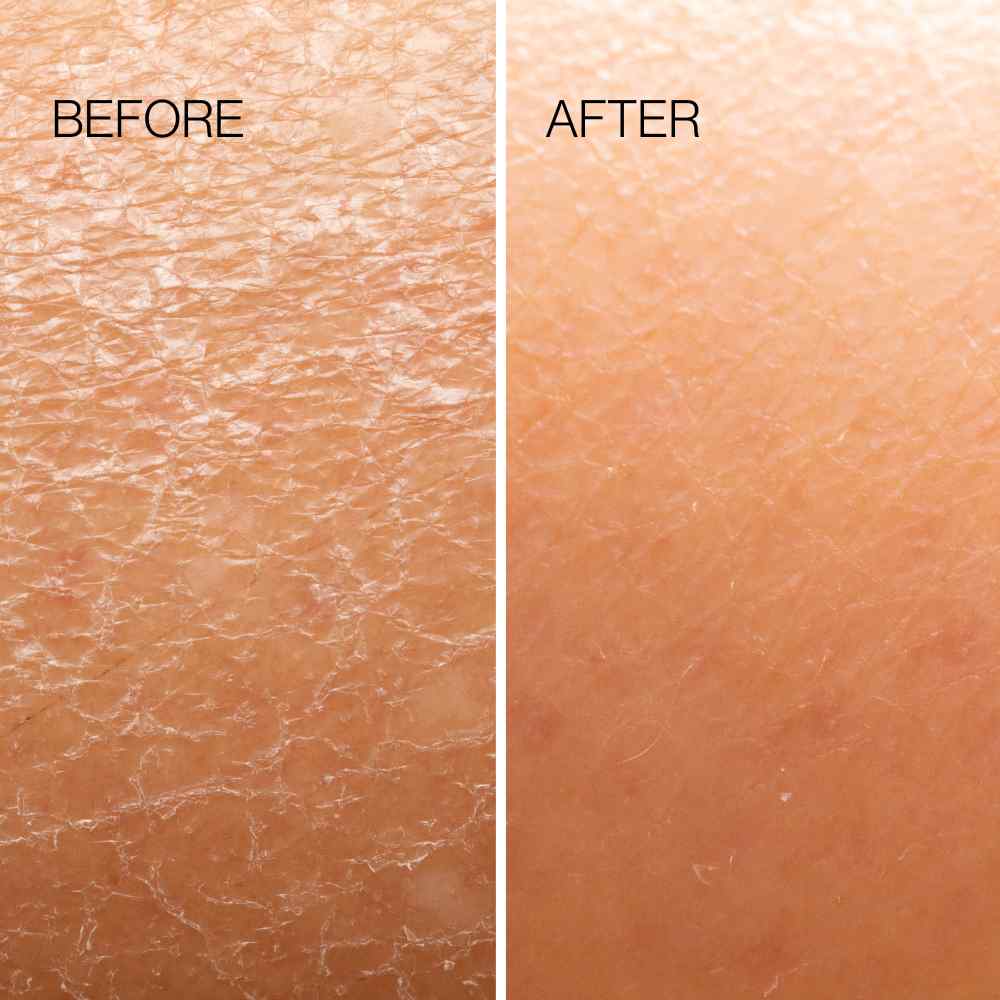 Body Plane Exfoliator Tool