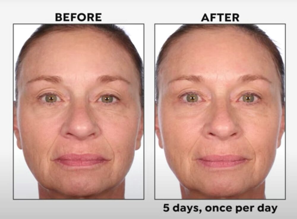 Black Rice 5-Day Brightening Serum